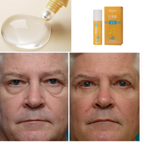 Roll-on 5 en 1 Ultra Rejuvenecedor Luteína Glow®