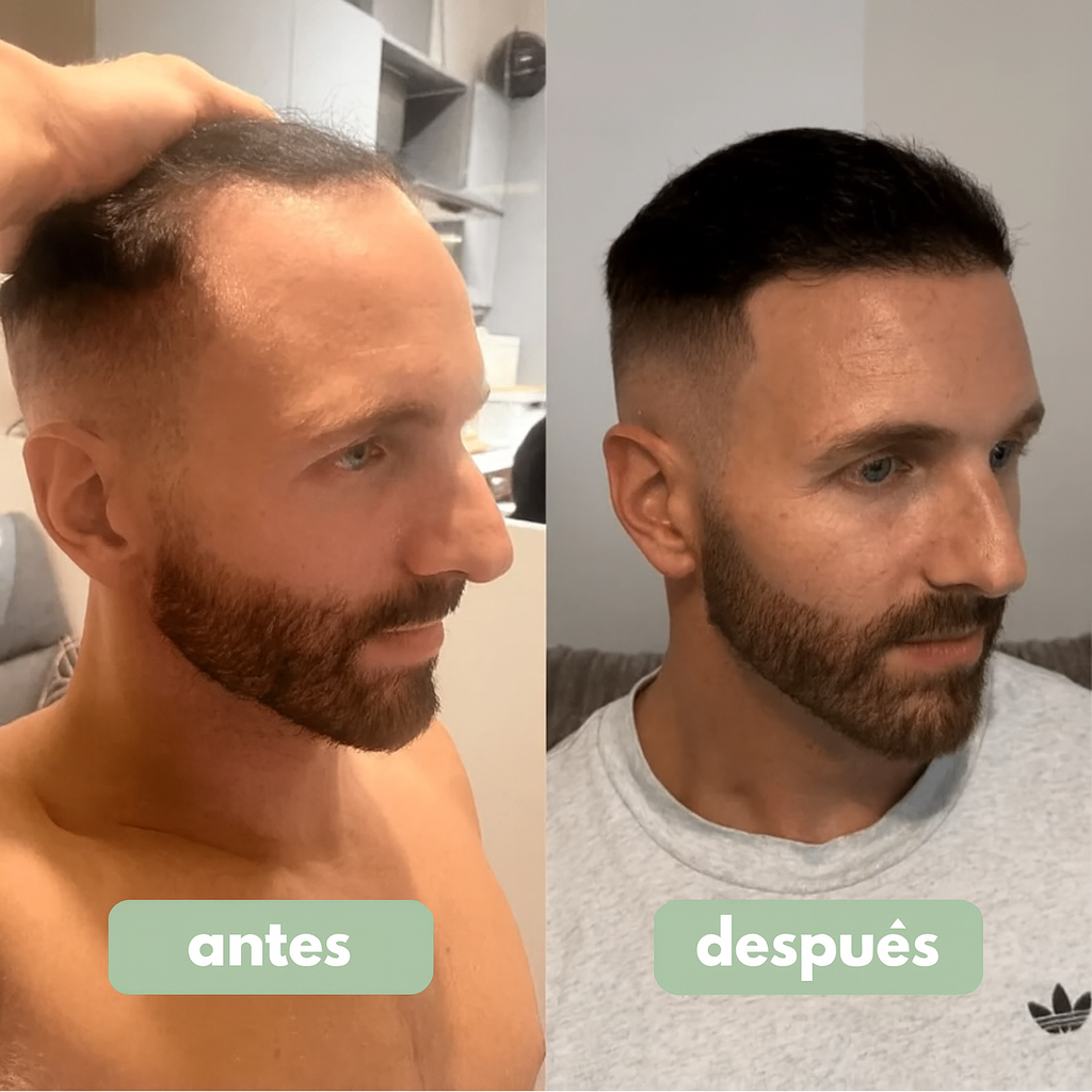 Reverse - Hair Growth Serum