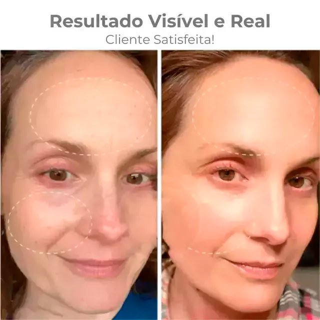 Masajeador Facial con Luz LED – Rejuvenecedor y Antiarrugas