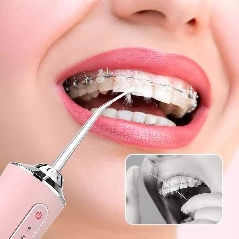 Irrigador Bucal Portátil CleanJet – Limpieza Profunda y Eficaz